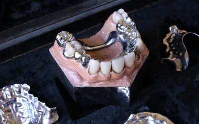 Antique Dental Salesman Set